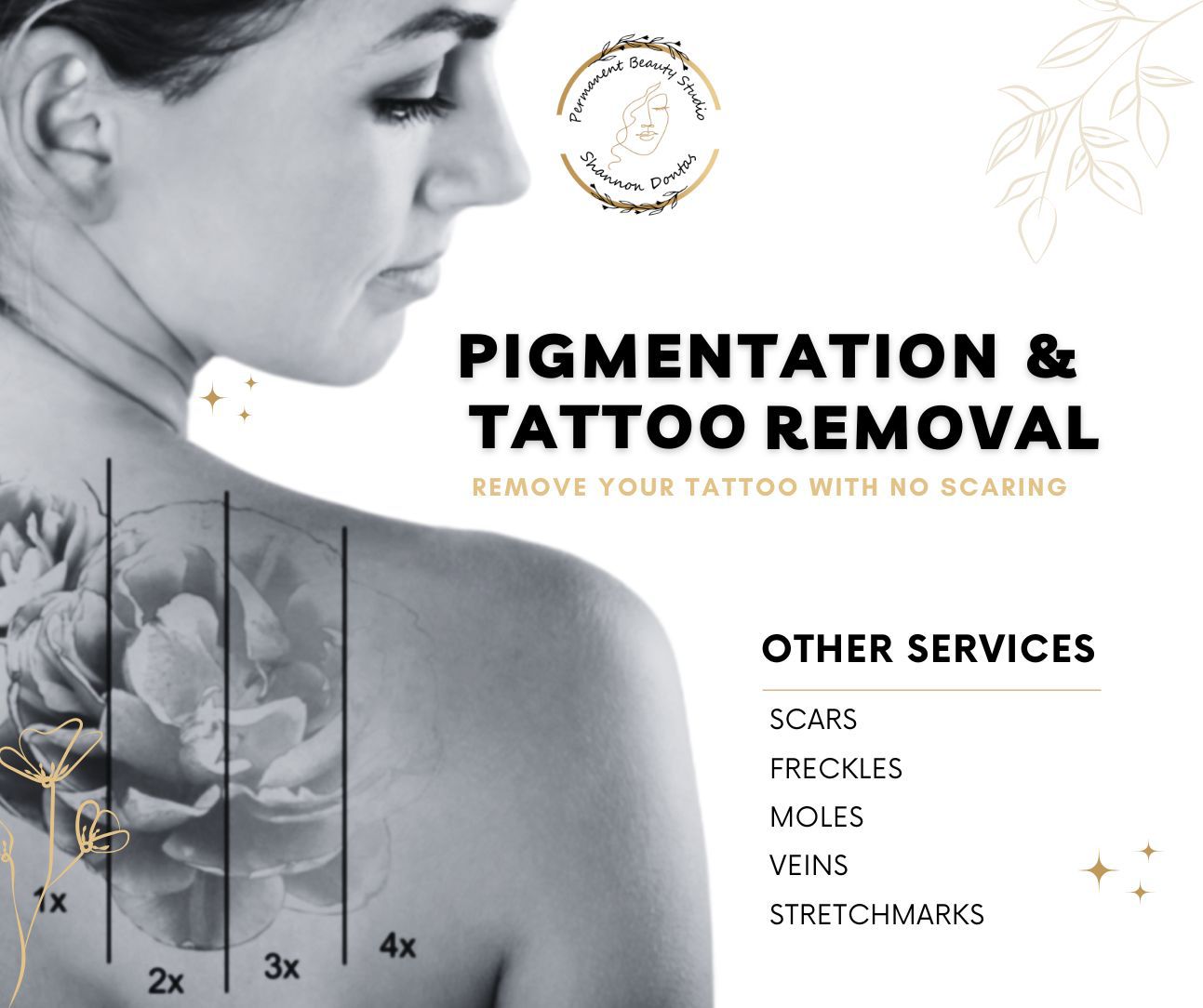 Pigmentation and Tattoo Removal
